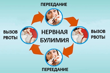 Лечение булимии в городе Инта